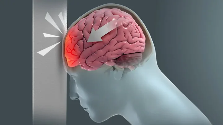 Traumatic Brain Injury Treatment in Pune