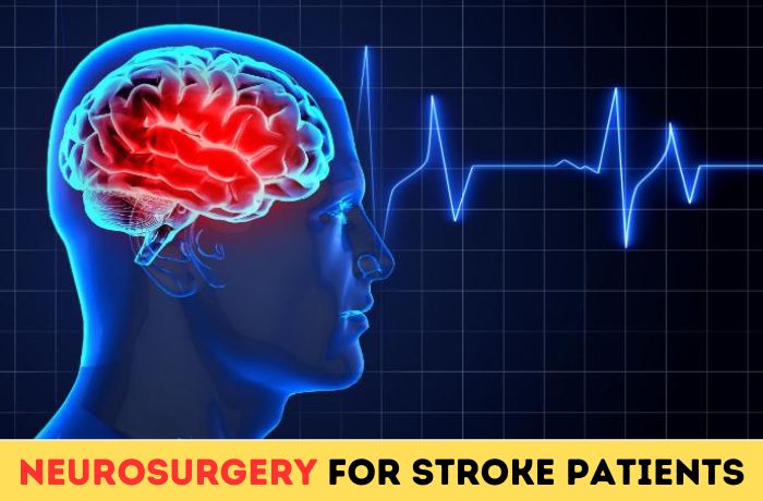 Neurosurgery for Stroke Patients