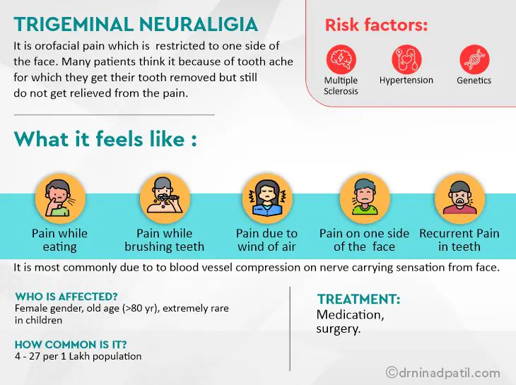 Trigeminal Neuralgia Treatment in Pune