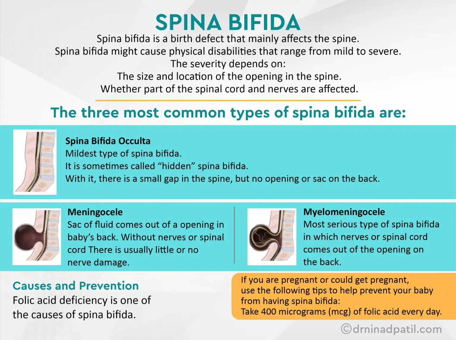 Spina Bifida Treatment in Pune | Dr.Ninad Patil