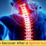 Tips To Recover After A Spinal Surgery