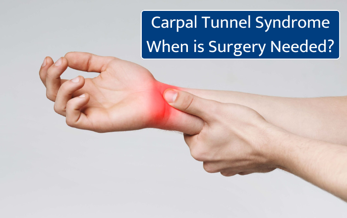 Carpal Tunnel Syndrome: When is Surgery Needed?