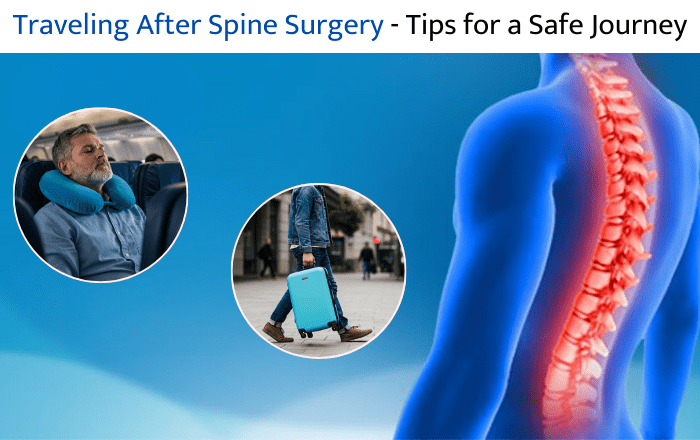 Traveling After Spine Surgery: Tips for a Safe Journey