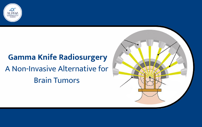 Gamma Knife Radiosurgery: A Non-Invasive Alternative for Brain Tumors