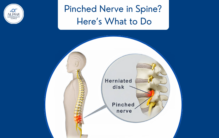 Pinched Nerve in Your Spine? Here’s What You Should Do Immediately