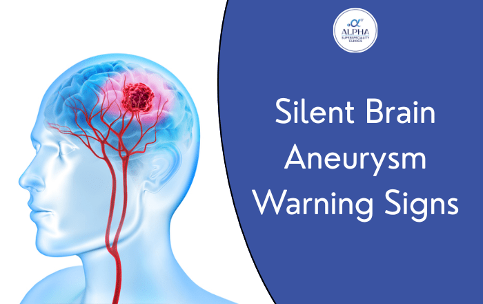 Silent Brain Aneurysm: Symptoms You Shouldn't Ignore