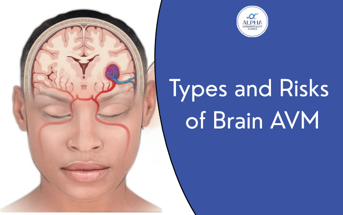 Types of Brain AVM: Size, Location, and Risk Factors