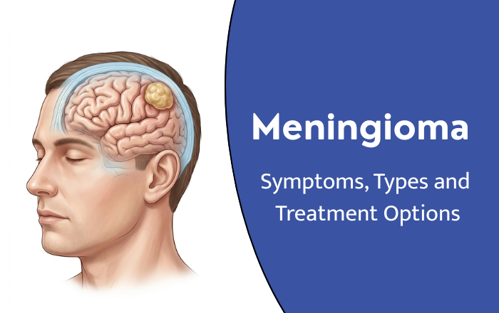 Meningioma: Symptoms, Types and Treatment Options